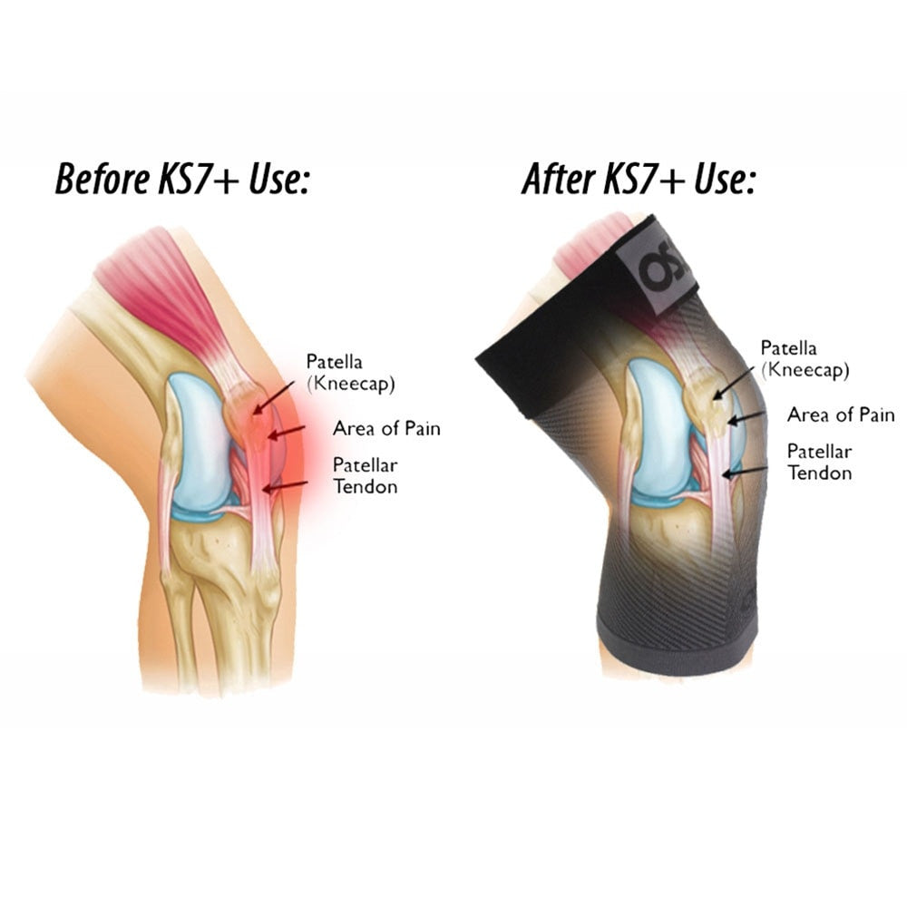 OS1st  KS7+ Adjustable Performance Knee Sleeve | Pickleball Sports Customer Favorite
